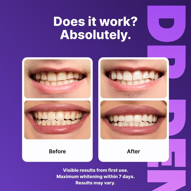PurplePolish™ Smile Strips - Direct Dealz Online Store