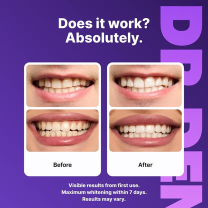 PurplePolish™ Smile Strips - Direct Dealz Online Store